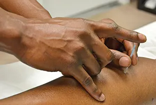 Dry Needling 101 — understanding this powerful therapy tool