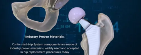 Personalized options for hip replacement patients