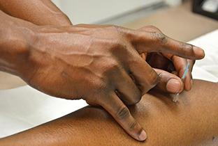 Dry Needling 101 — understanding this powerful therapy tool thumbnail